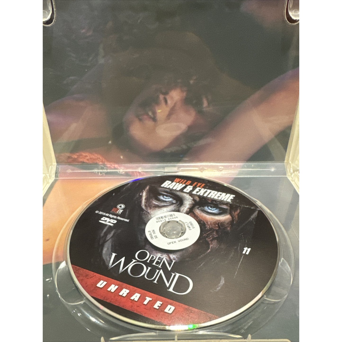 Open Wound - DVD Used